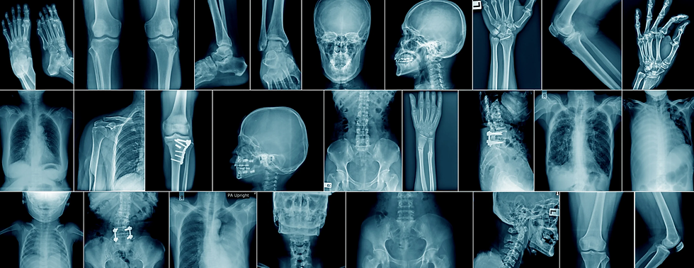 x-ray-skeleton-2x.jpg
