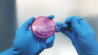 Mãos enluva das em azul segurando uma placa de Petri com cultura bacteriana, com duas agulhas de inoculação, simbolizando análise laboratorial e diagnóstico científico.
