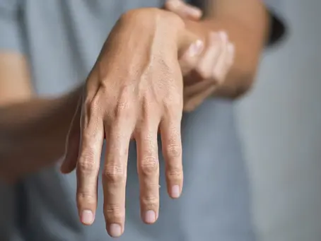 Sudden Onset of Wrist Drop: Clinical Recognition and an Uncommon Etiological Insight