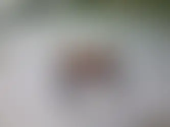 A set of dental implants prepared for an All-on-4 dental implant procedure in Perth dental clinic, Nicholson Road Implant & Dental Centre.