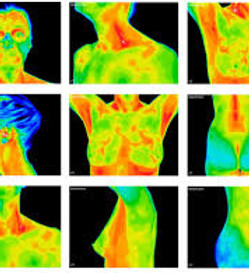 thermography.jfif