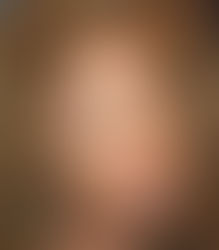 Botox-Doc Rolls the Dice on Poker Face Scheme. Healthcare? You be the Judge