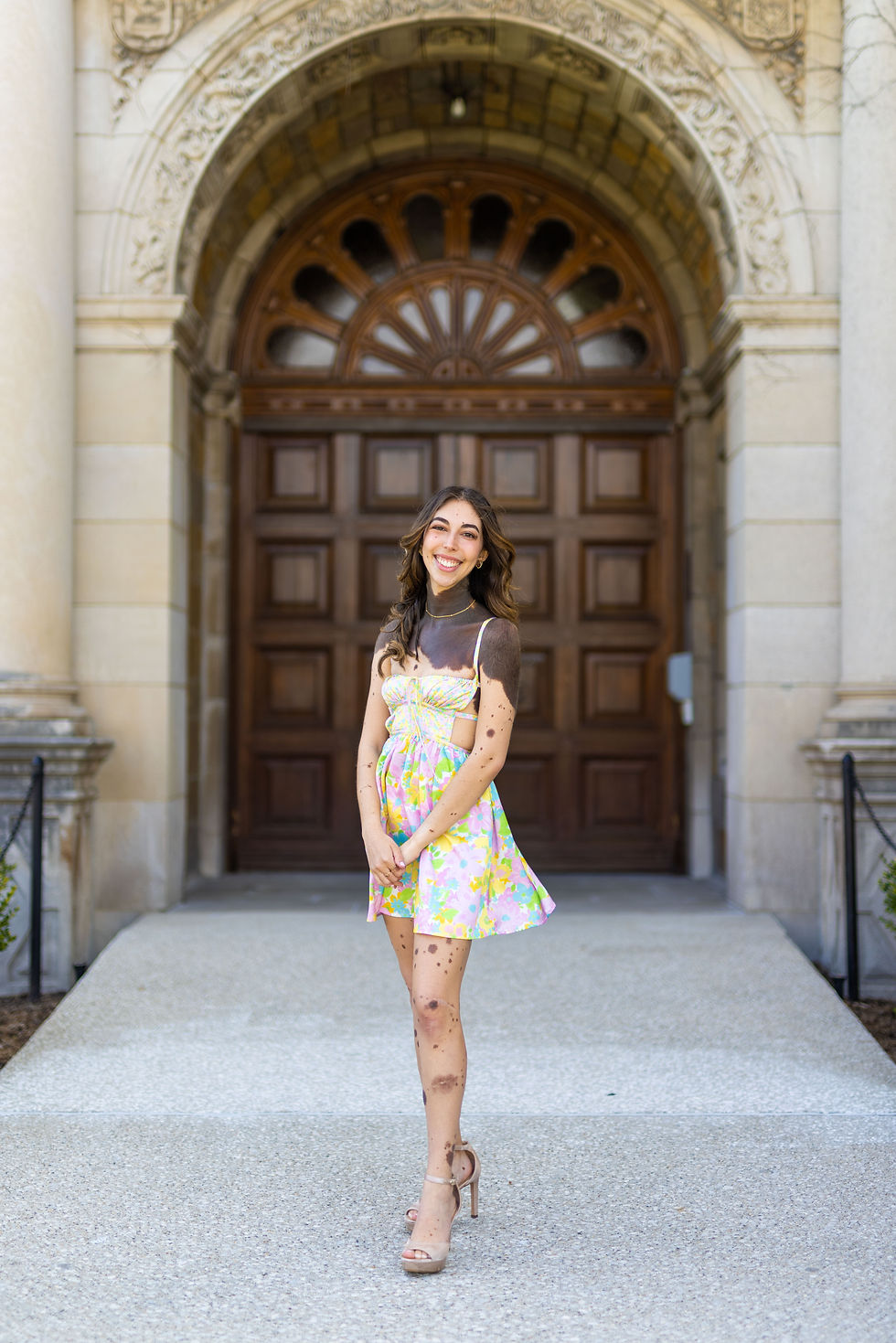 A woman stands in a floral sundress in front of a historical brown door. She has a Giant Congenital Melanocytic Cape nevus- extending from her neck down her chest and arms. She has smaller nevi adorning her arms and legs. She stands tall in gold heels, posing in the wind with long brown wavy hair draping across her shoulders.