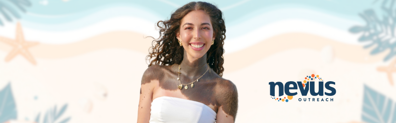 A confident woman smiles at the camera with her long brown hair blowing off her shoulders behind her. She wears a charm gold necklace which drapes on her neck. She has a Giant Melanocytic Nevus on her neck, down her shoulders and arms. She has smaller nevi scattered across her chest and arms. She is wearing a white sleevless blouse and the background is a beach theme with a Nevus Outreach Logo to the right corner.