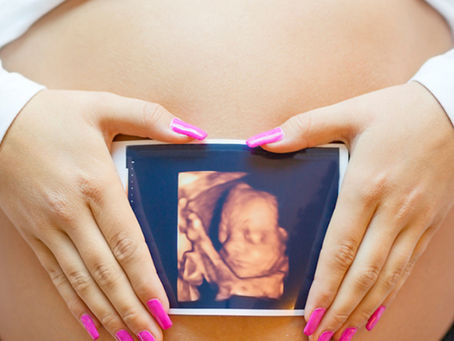Yaneth Arteta / ¿El derecho al aborto o a la vida? (2 de 2)