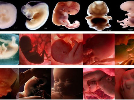 Yaneth Arteta / ¿El derecho al aborto o a la vida? (1 de 2)