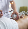 Fire Cupping