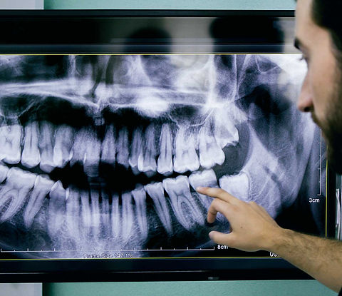 Dentist looking at an X-ray