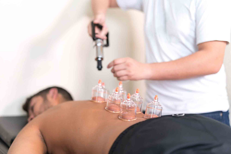 Applying cupping therapy in traditional chinese medicine on man back.jpg