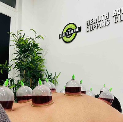 Cupping process in action at Health Avenue Cupping Clinic Hijama