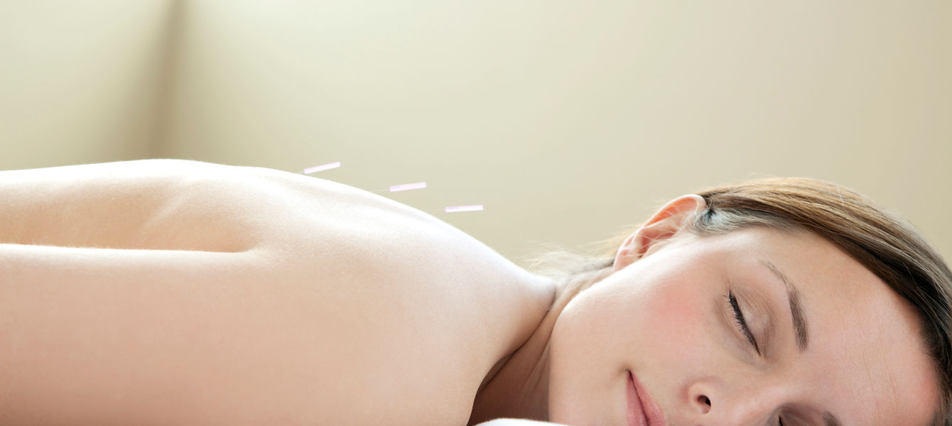 Acupuncture