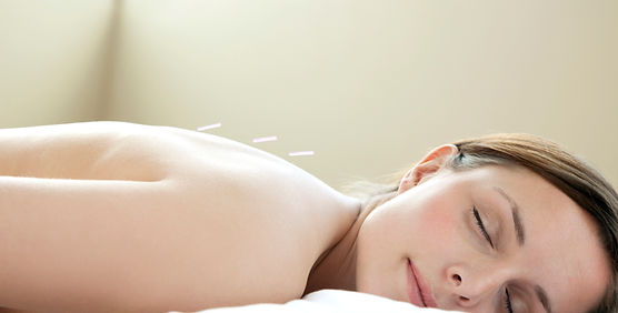 Acupuncture