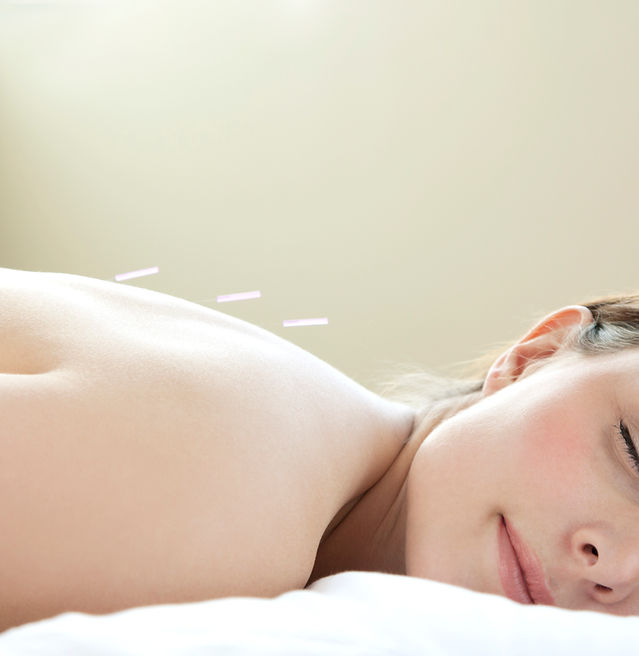 Dry Needling Charlotte NC