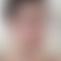 Permanent Lip Makeup in Seoul: Everything You Need to Know Before Booking at INMOREBEAUTY SEOUL (Gangnam)