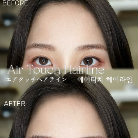 Thinking About Hairline PMU? Here's What Happens at INMOREBEAUTY SEOUL First