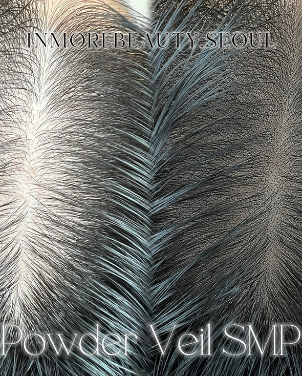 Powder veil scalp micropigmentation (SMP) for hairline density at INMOREBEAUTY SEOUL, Gangnam