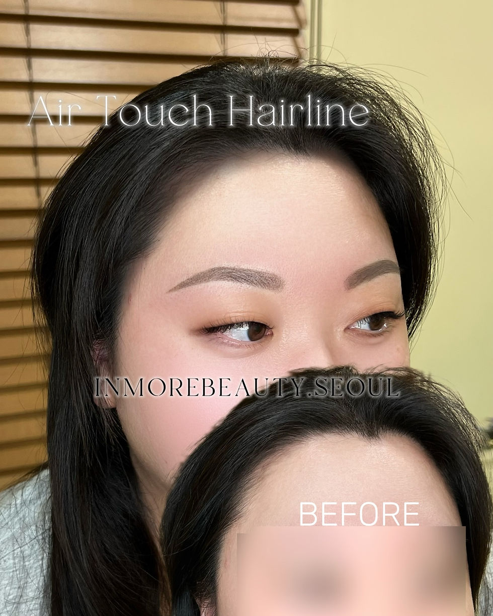 Air touch hairline tattoo with soft powder framing at INMOREBEAUTY SEOUL, Korean PMU studio in Gangnam