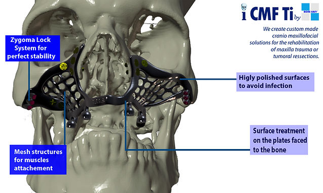Flyer_iCMF Ti_maxila_EN.jpg