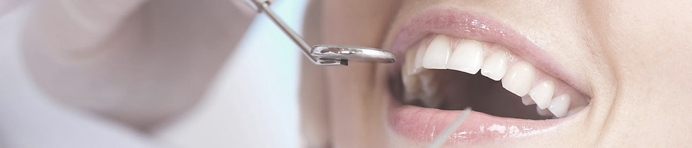 Tooth Cleaning with Neodent Dental Group