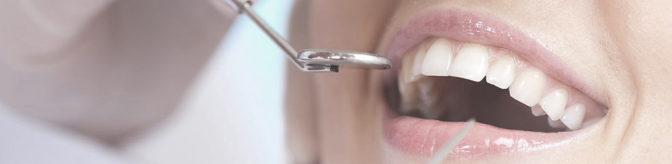 Tooth Cleaning with Neodent Dental Group