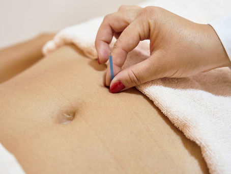 Acupuncture