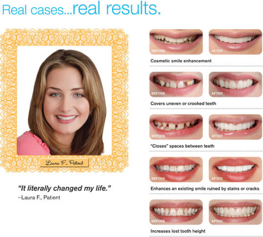 what-is-it_real_cases.jpeg