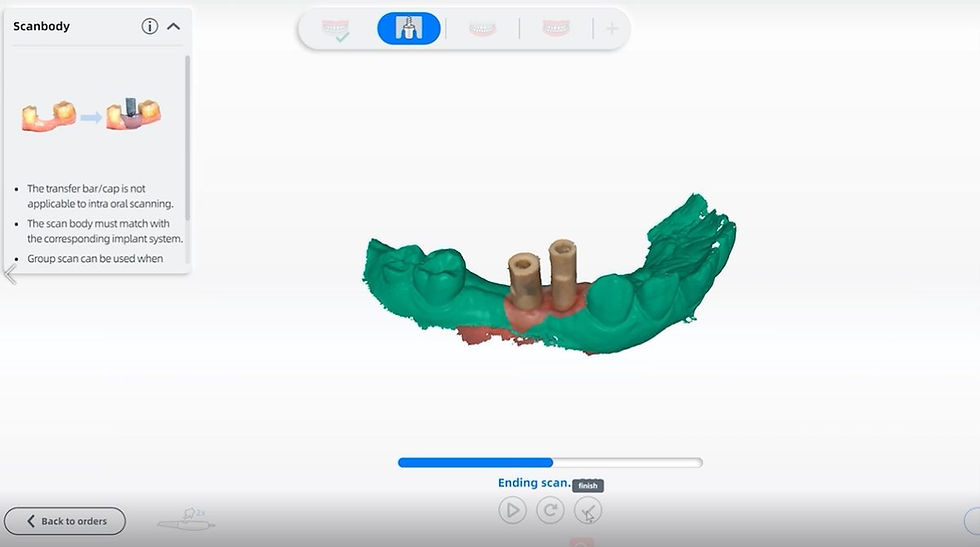 AORALSCAN software for the AORALSCAN 3 intraoral scanner from Osseo Group