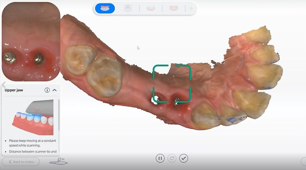 AORALSCAN software for the AORALSCAN 3 intraoral scanner from Osseo Group