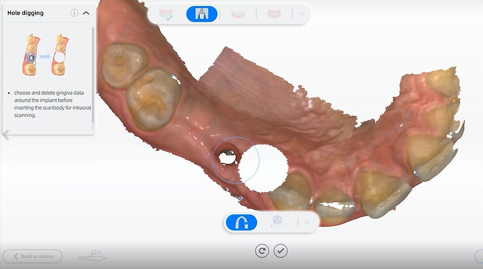 AORALSCAN software for the AORALSCAN 3 intraoral scanner from Osseo Group