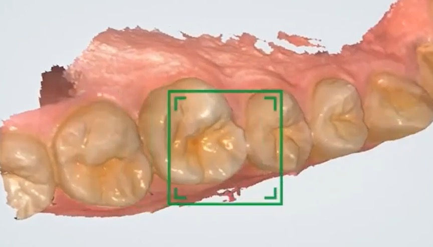 Scanning with AI