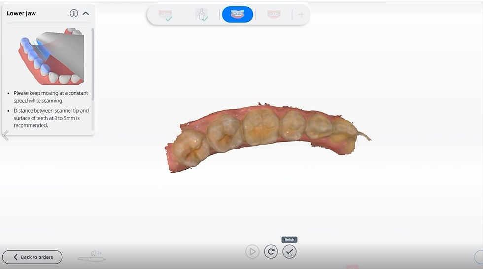 AORALSCAN software for the AORALSCAN 3 intraoral scanner from Osseo Group
