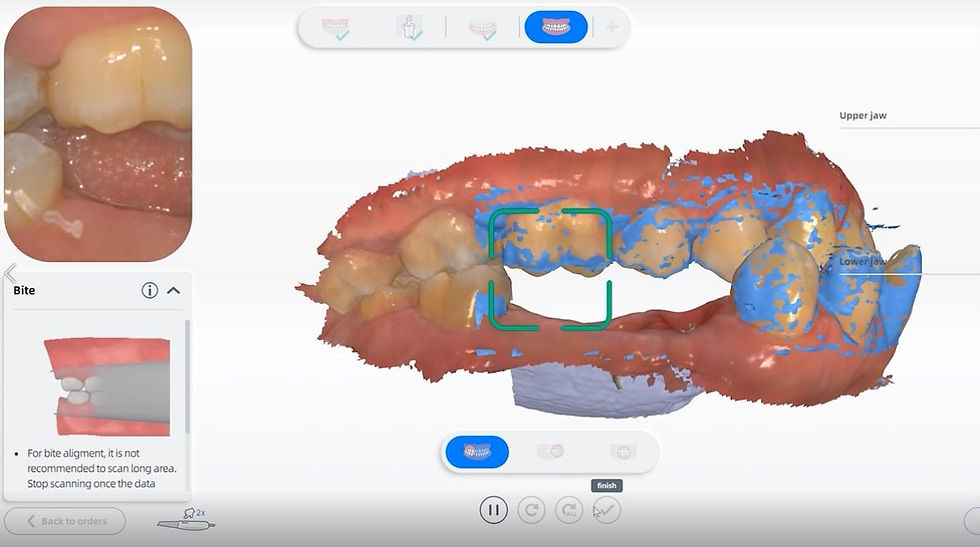 AORALSCAN software for the AORALSCAN 3 intraoral scanner from Osseo Group