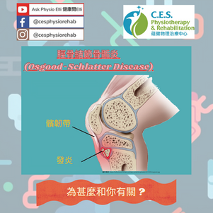 脛骨結節骨骺炎 - 為什麼對您很重要?