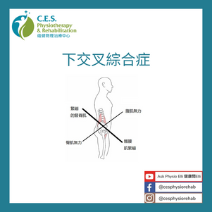 下交叉綜合症