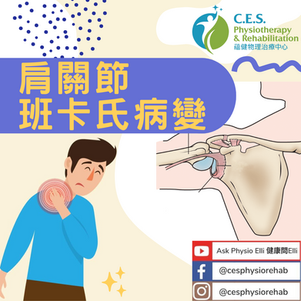 什麼是肩關節班卡氏病變?