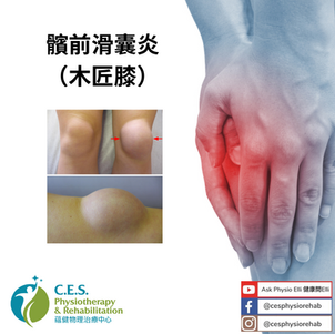 髕前滑囊炎(木匠膝)