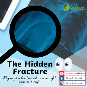 The Hidden Fracture