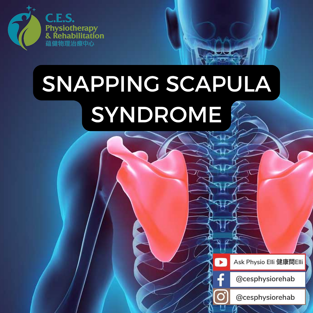 Snapping Scapula Syndrome Snapping Scapula Syndrome