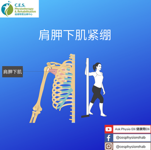 肩胛下肌紧绷