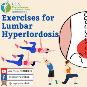 Posture Deviation – Exercises for Lumbar hyperlordosis 