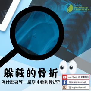 躲藏的骨折
