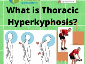 Thoracic Hyperkyphosis (Roundback)