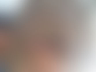 Bədənində 79 qəlpə gəzdirən qazimiz - FOTOLAR