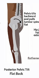 posture with ant rot pelvis.jpg