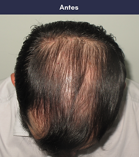 Kopie von 5 copy 4.png