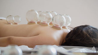 Medical glass cups in the massage room on the background of physiotherapy.jpg