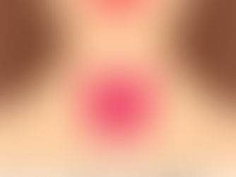 How to do a thyroid self-exam