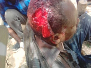 More news on deaths, injuries from Kalma IDP camp, South Darfur