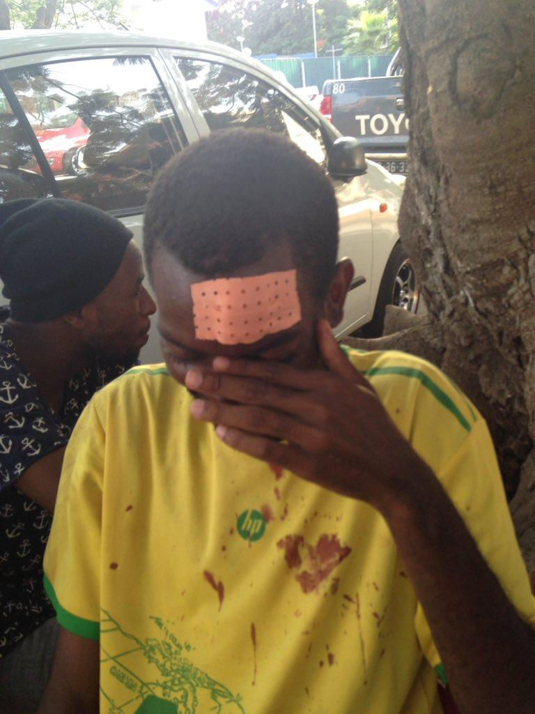 “Samussuku” Chiconda required stitches on his forehead after police officers beat him with batons, Luanda, February 24, 2017. © 2017 Luaty Beirao