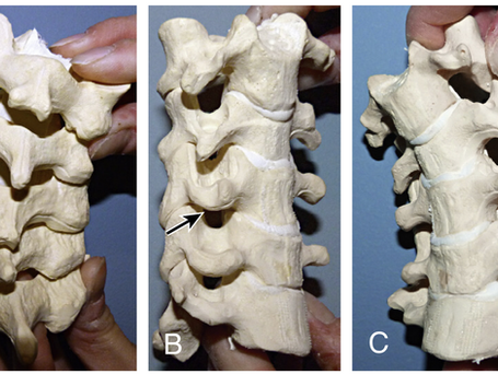 COLUMNA CERVICAL